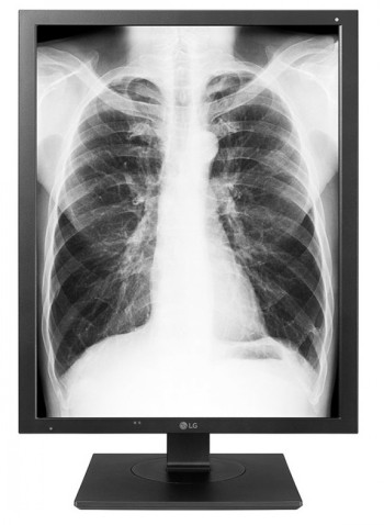 LG 21HK512D 21